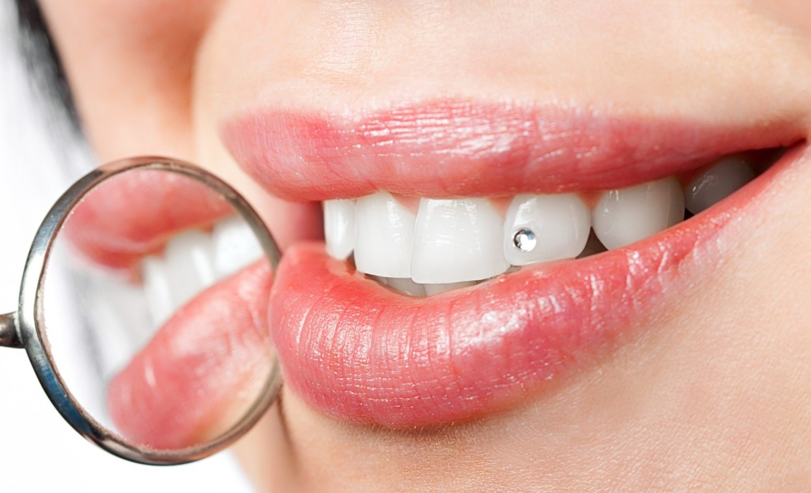 Tandkristal plaatsing – subtiel glimlachaccent – Peau-tique Menen